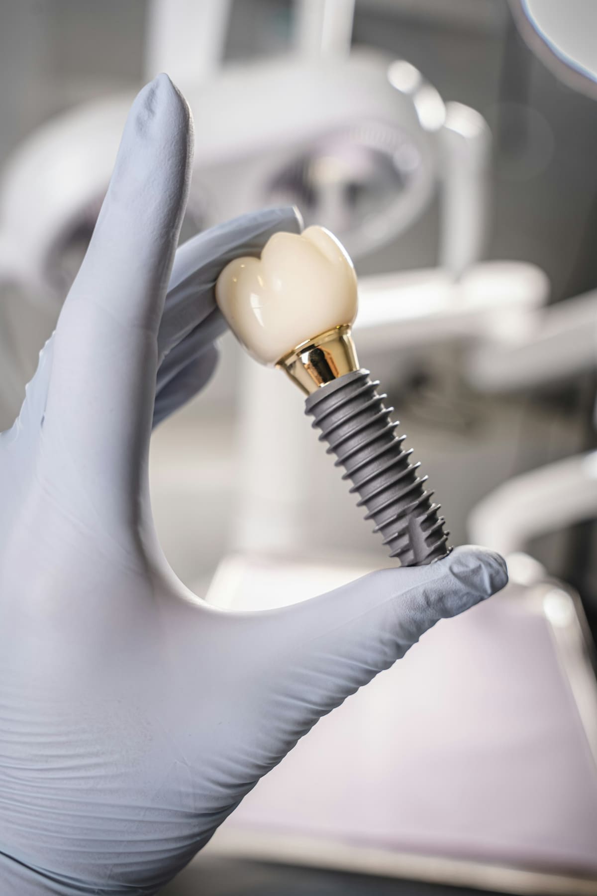 A dental implant with its ceramic crown attached, held in a gloved hand
